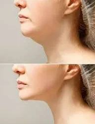 Cuando el cuidado profundo se vuelve delicado